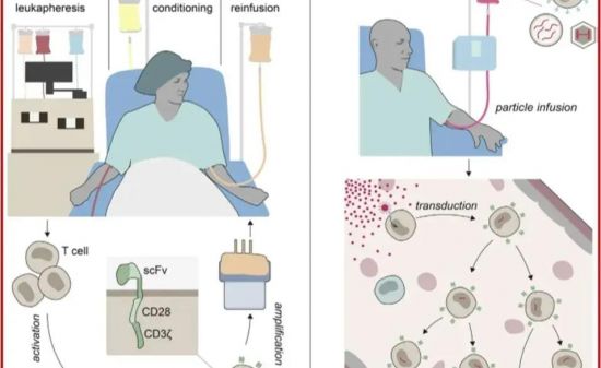 Lentiviral In Vivo CAR-T: Achieving Dual Breakthroughs in Transduction Efficiency and Safety