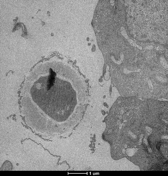Fig. 2 Fungal Contaminant