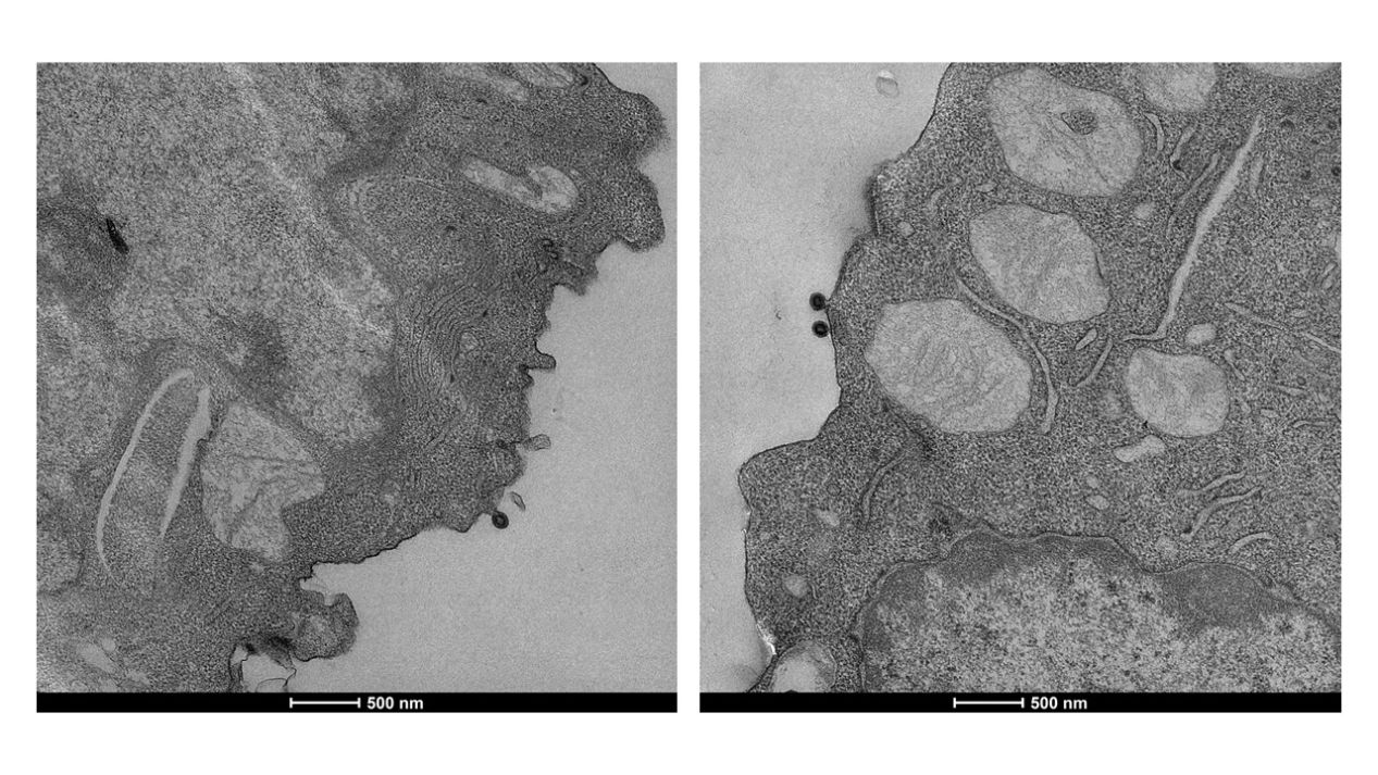 Fig. 1 Type C Retrovirus During and After Budding